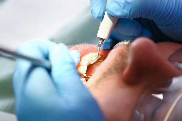 Best Emergency Root Canal Therapy in Chamberlayne, VA