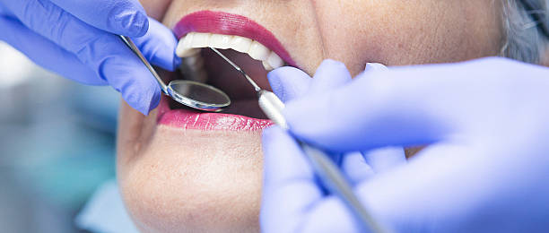 Best Emergency Wisdom Tooth Extraction in Chamberlayne, VA